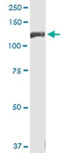 INSRR Monoclonal Antibody (5C6)