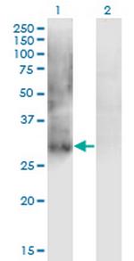 IPF1 Monoclonal Antibody (4E12)
