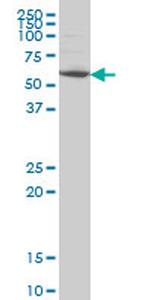 IRAK2 Monoclonal Antibody (3H1)