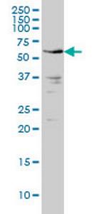 IRAK2 Monoclonal Antibody (1A6)