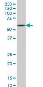 IRAK2 Monoclonal Antibody (4C11)