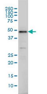 IRF2 Monoclonal Antibody (3B5)
