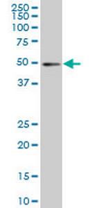 IRF2 Monoclonal Antibody (7C2)
