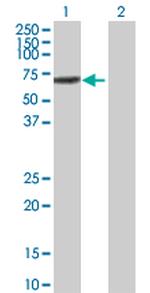 IRF5 Antibody in Western Blot (WB)