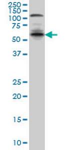 IRF5 Monoclonal Antibody (3C2)
