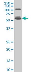 IRF5 Antibody in Western Blot (WB)