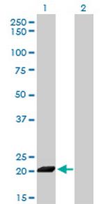 ISG20 Monoclonal Antibody (1B2-3C9)
