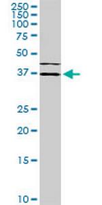 ISL1 Monoclonal Antibody (1A3)