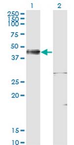 ISL1 Monoclonal Antibody (4A7)
