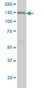 ITGA2 Monoclonal Antibody (2B6)