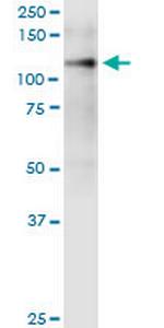 ITGA9 Antibody in Western Blot (WB)