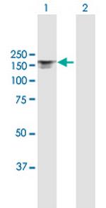 ITGAX Antibody in Western Blot (WB)