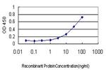 ITGB2 Monoclonal Antibody (5F12)