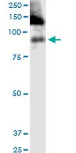 ITGB2 Antibody in Western Blot (WB)