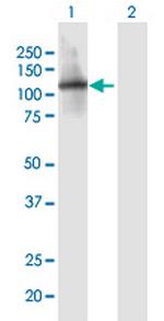 ITIH1 Polyclonal Antibody, MaxPab™
