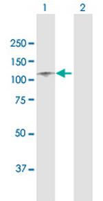 ITIH1 Antibody in Western Blot (WB)