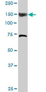 ITPKB Antibody in Western Blot (WB)