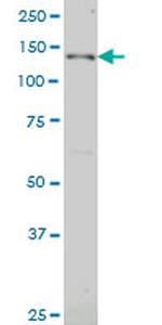 JAG2 Monoclonal Antibody (1C5)