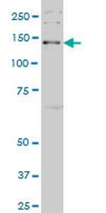 JAG2 Antibody in Western Blot (WB)