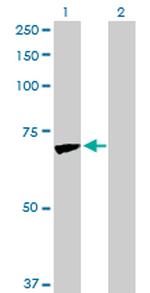 JUP Antibody in Western Blot (WB)
