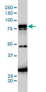 JUP Monoclonal Antibody (2G9)