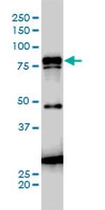JUP Antibody in Western Blot (WB)