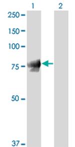 JUP Antibody in Western Blot (WB)