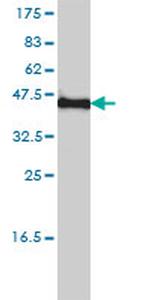KCNF1 Antibody in Western Blot (WB)