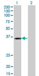 KCNJ15 Antibody in Western Blot (WB)