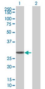 KHK Polyclonal Antibody, MaxPab™