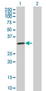 KHK Polyclonal Antibody, MaxPab™