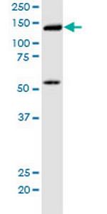 KIF5B Monoclonal Antibody (2A11)