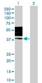 KIR2DL3 Antibody in Western Blot (WB)