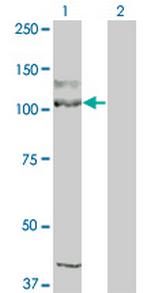 KIT Monoclonal Antibody (1G1)