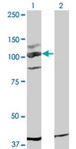 KIT Monoclonal Antibody (5F6)