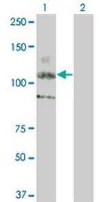 KIT Antibody in Western Blot (WB)