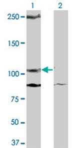 KIT Monoclonal Antibody (2C3)