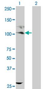 KIT Monoclonal Antibody (1D3)