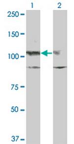 KIT Monoclonal Antibody (X1)