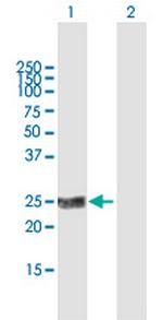 KLK2 Polyclonal Antibody, MaxPab™