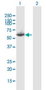 KNG1 Polyclonal Antibody, MaxPab™