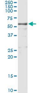 KNG1 Monoclonal Antibody (4A1)