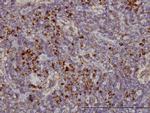KIFC1 Antibody in Immunohistochemistry (Paraffin) (IHC (P))