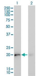 KRAS Monoclonal Antibody (4F3)