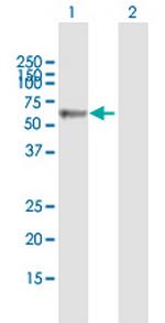 KRT4 Polyclonal Antibody, MaxPab™