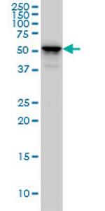 KRT4 Monoclonal Antibody (5H5)