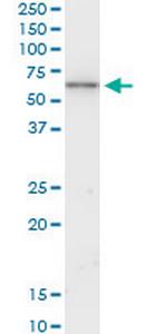 KRT6B Monoclonal Antibody (4G9)