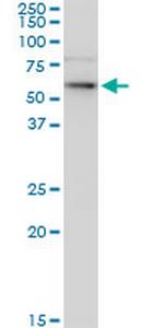 KRT6B Monoclonal Antibody (1C4)