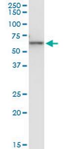 KRT6B Monoclonal Antibody (3C4)
