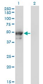 KRT8 Monoclonal Antibody (3E3)